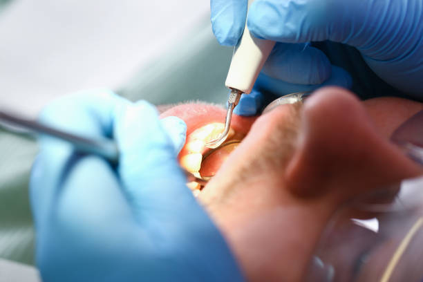 Best Emergency Orthodontic Services in Cambria, IL