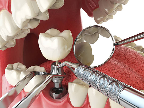 Best Cosmetic Emergency Dentistry in Cambria, IL